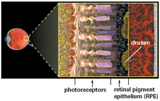 picture_of_retina_showing_rpe_layer